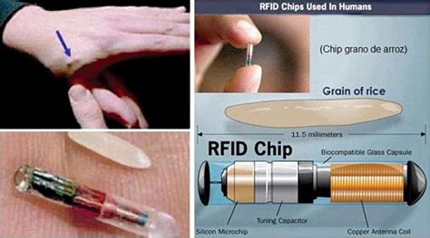 how small are rfid chips|rfid for personal use.